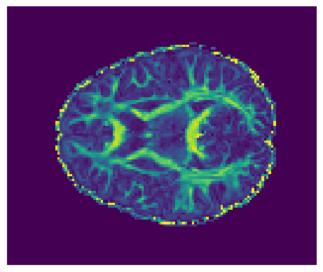../../_images/59fe03523cc3ab7f377472f68db7834070d94b89aeb0b9f07d95ebe9c2c58736.png
