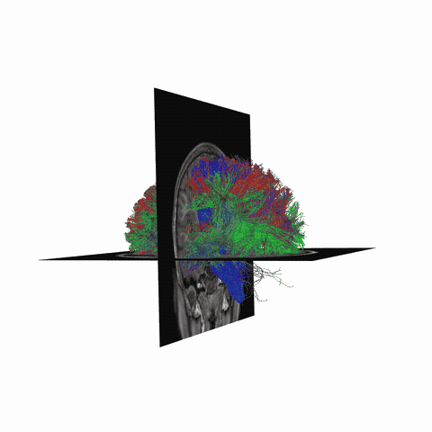 ../_images/sphx_glr_plot_stages_of_tractometry_004.gif