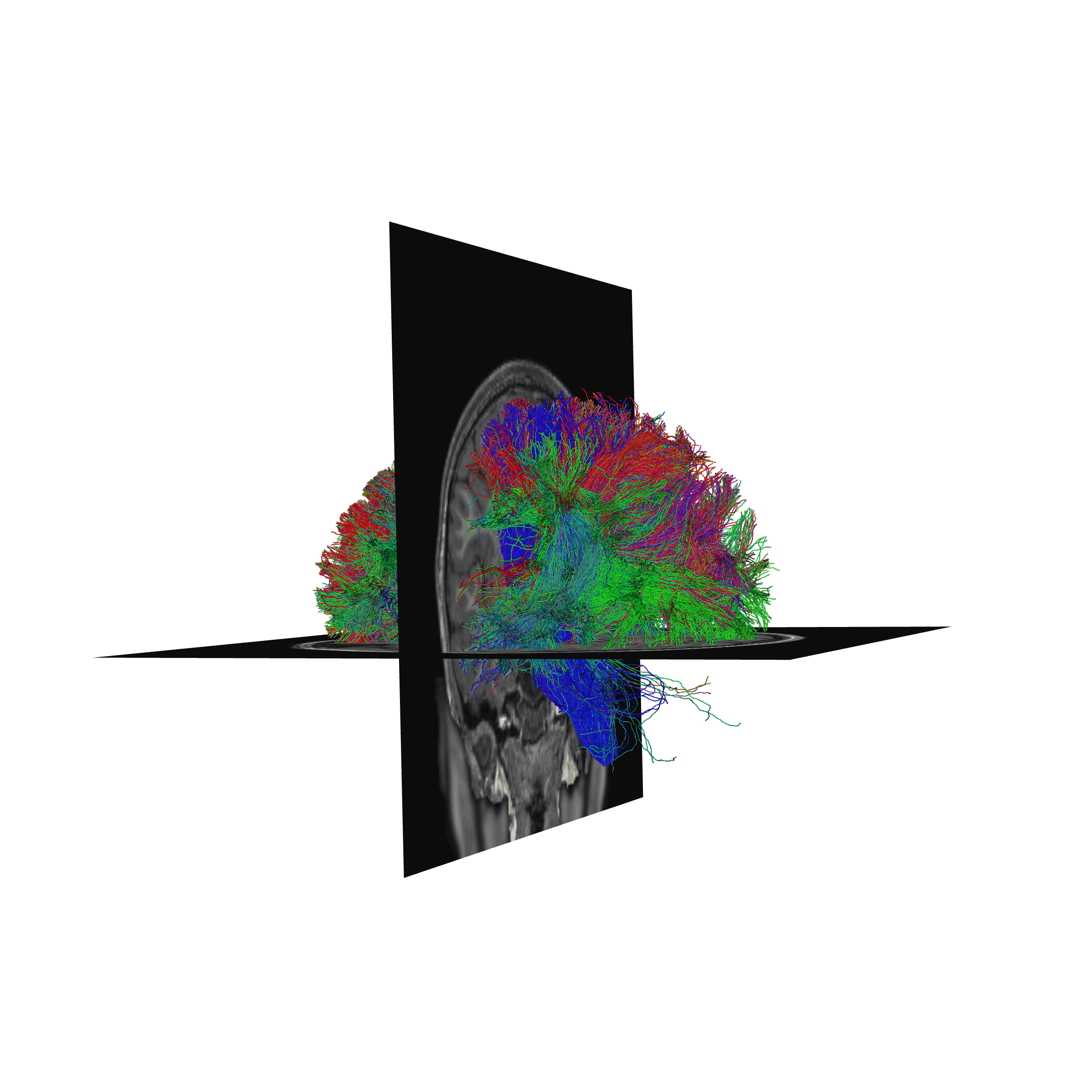 plot stages of tractometry