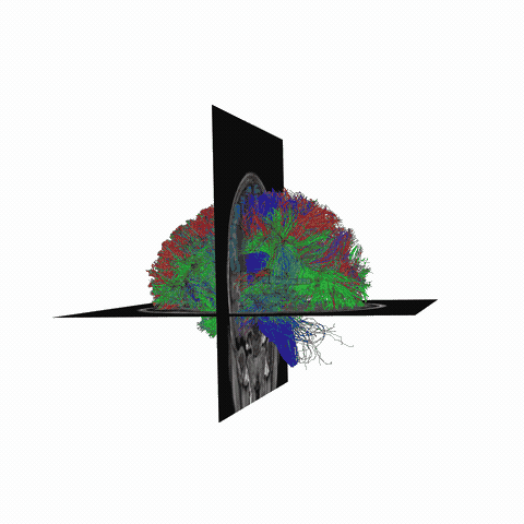 ../_images/sphx_glr_plot_stages_of_tractometry_005.gif