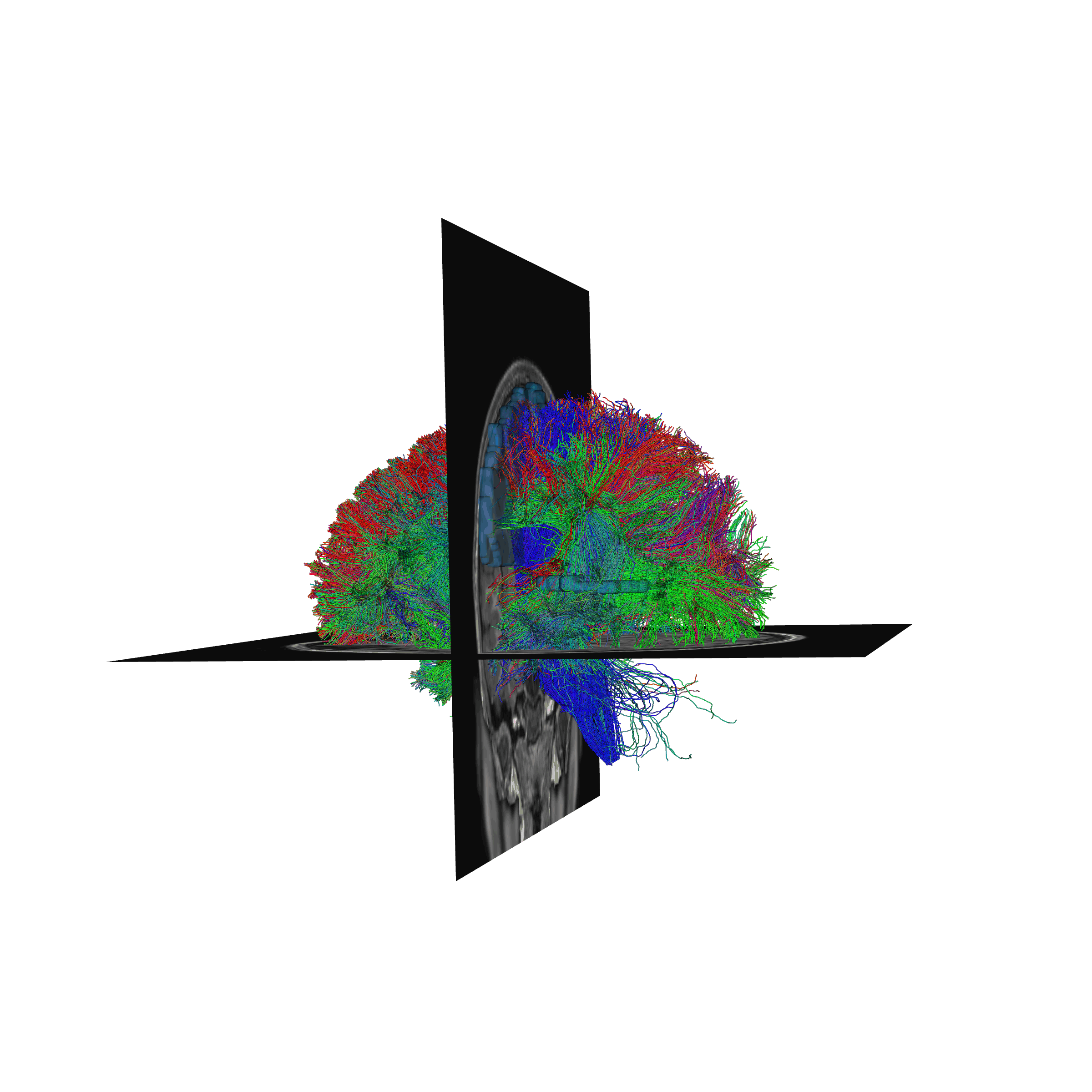 plot stages of tractometry