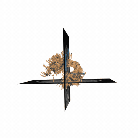 ../_images/sphx_glr_plot_stages_of_tractometry_006.gif