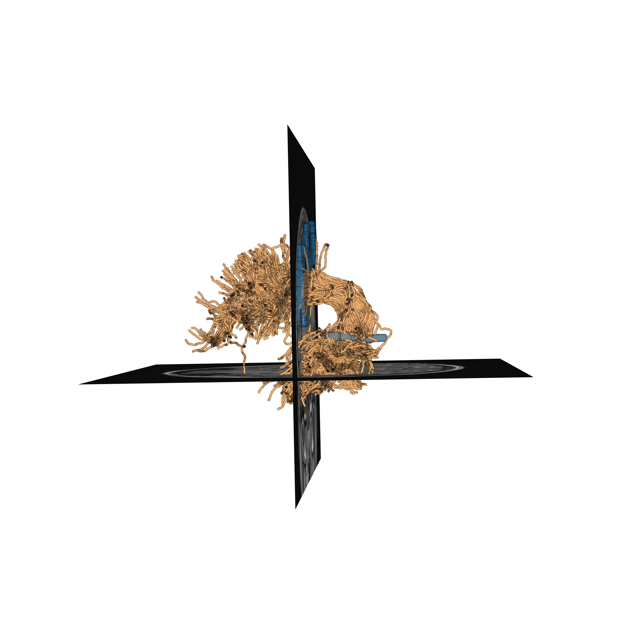 plot stages of tractometry