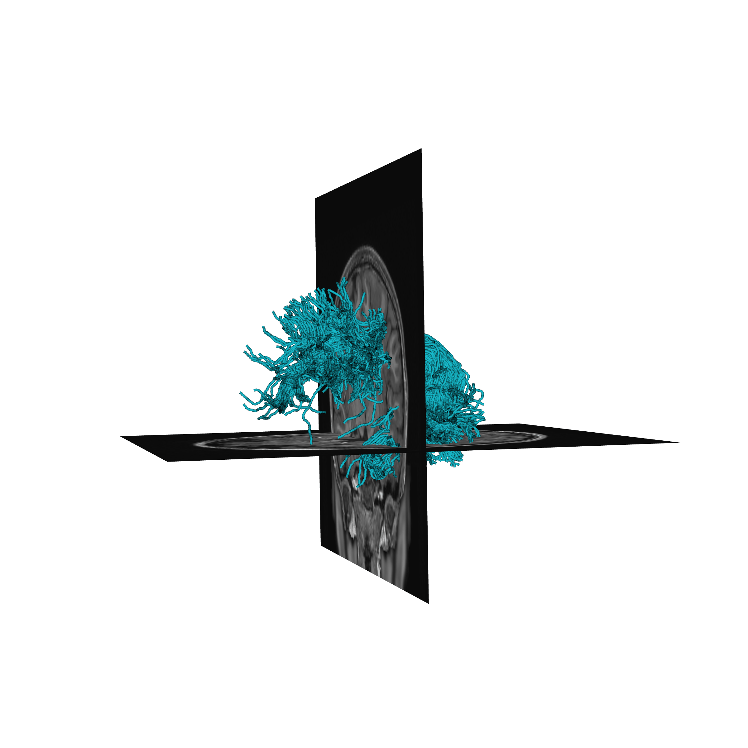 plot stages of tractometry