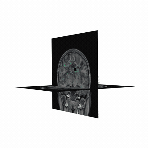 ../_images/sphx_glr_plot_stages_of_tractometry_010.gif