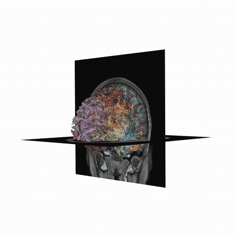 ../_images/sphx_glr_plot_stages_of_tractometry_011.gif
