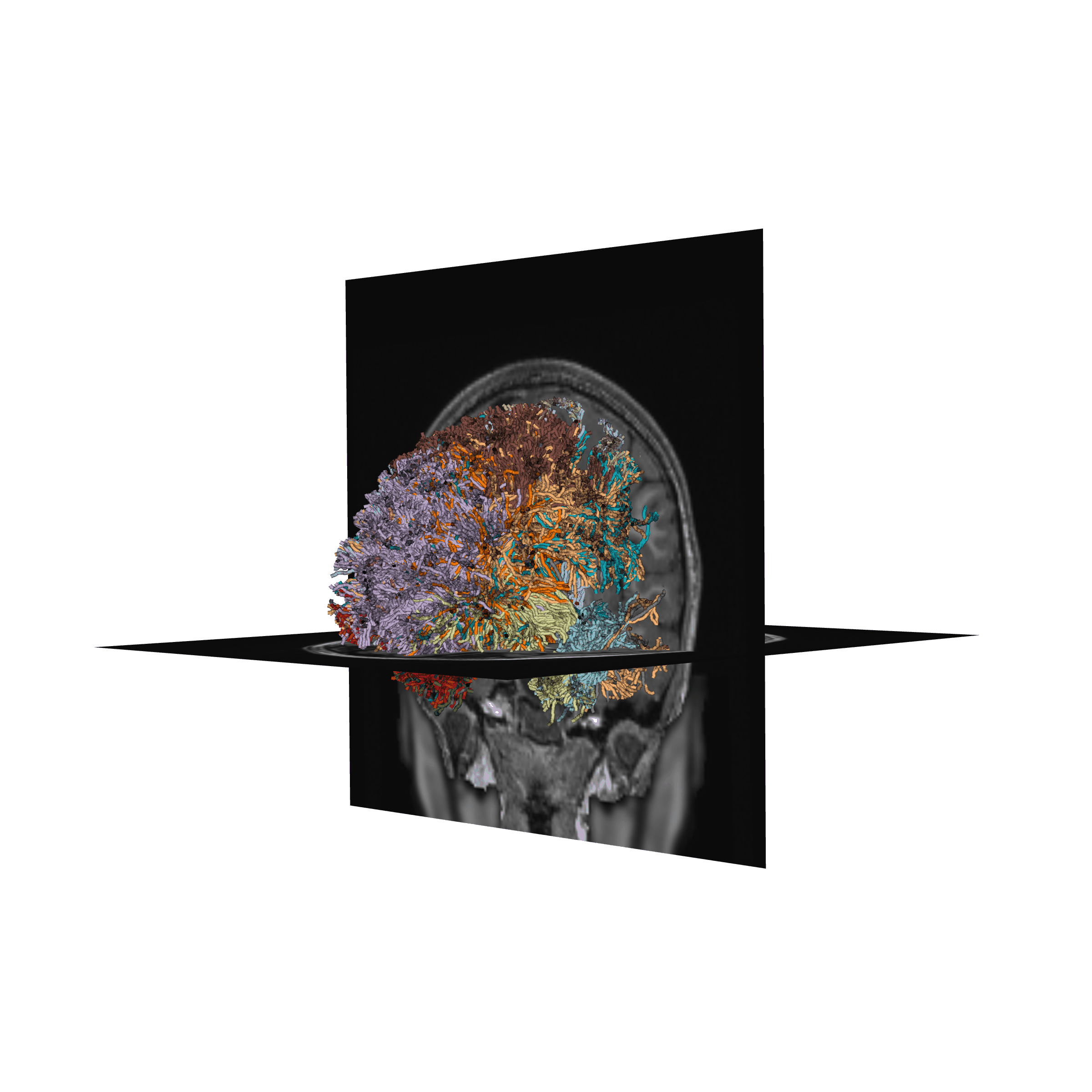 plot stages of tractometry